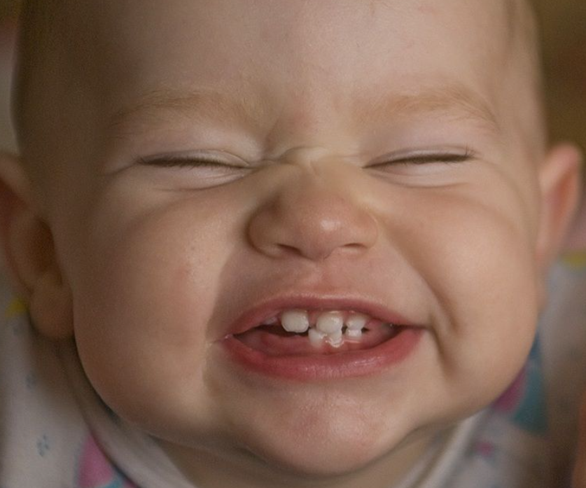 A është normale që bebi im nuk ka ende dhëmbë?