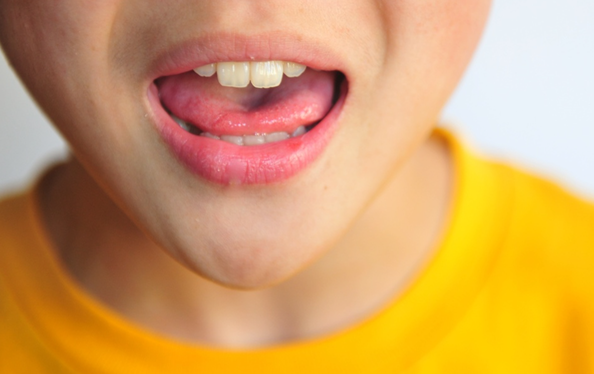 A mund ta ndihmoj fëmijën tim të mos flasë si thuthuq?