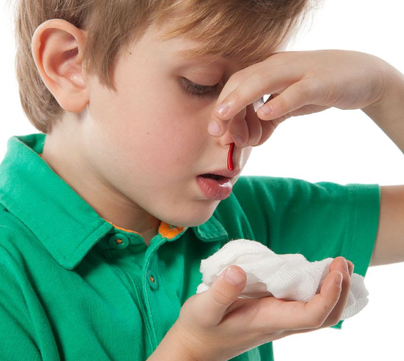 Gjaku nga hunda te fëmijët: Ç'duhet të dini dhe si ta ndaloni në mënyrë të sigurt